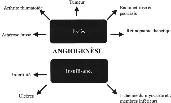 Figure 13. Implication de l’angiogenèse dans certaines pathologies