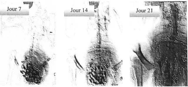 Figure 3.1-Évolution des déformations scoliotiques chez le poulet pinéalectomisé en croissance