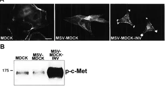 Figure 1. 10 : Représentation des cellules MDCK, MSV-MDCK et MSV-MDCK-INV et niveau d’expression de c-Met phosphorylé.
