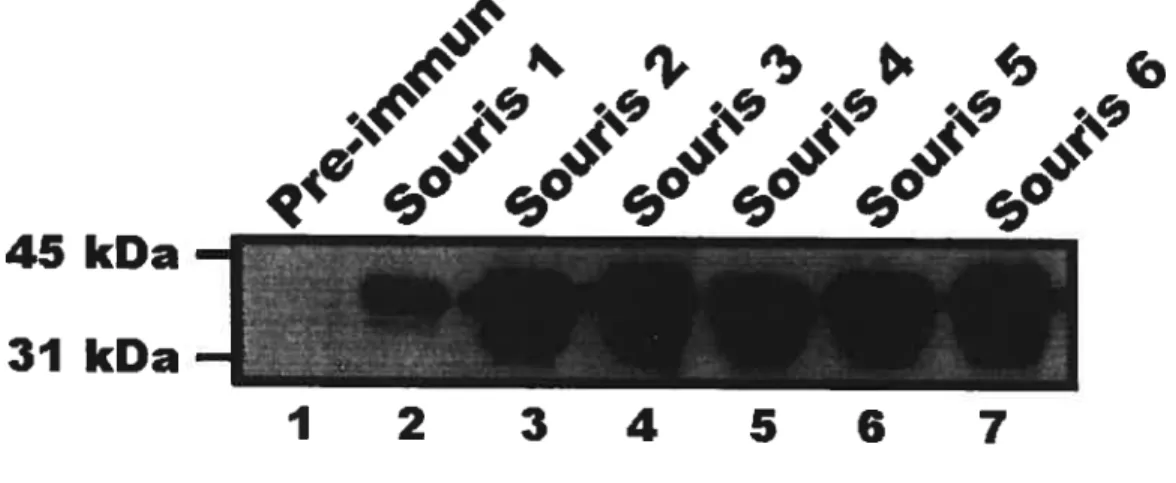 Figure 1: ÉvaLuation des différents antisémms provenant des souris immunisées avec un fragment de ECELI comme antigène