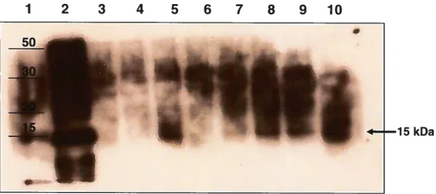 Figure 3.1 : Expression de 1’ARFP dans des cellules CVJ infectées avec le vaccinia ARFP-recombinant (vvARFP).