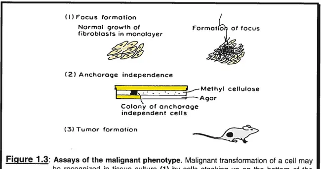 Figure 1 3: Assays of the malignant phenotype. Malignant transformation of a ceil may be recognized in tissue culture (1) by celis stacking up on the bottom of the culture dish to form a focus; (2) by growth under anchorage-independent conditions in semiso