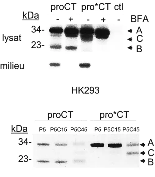 Figure 10: Maturation précoce du proCT