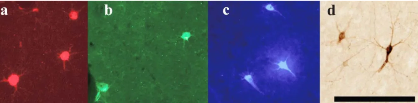 Figure 3.Photomicrographs of retrogradely labeled cells in the hemisphere ipsilateral to  the injection of neuronal tracer