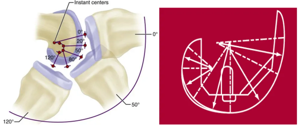 Figure 17 – Surface articulaire en forme de « J » et implant à rayons multiples 