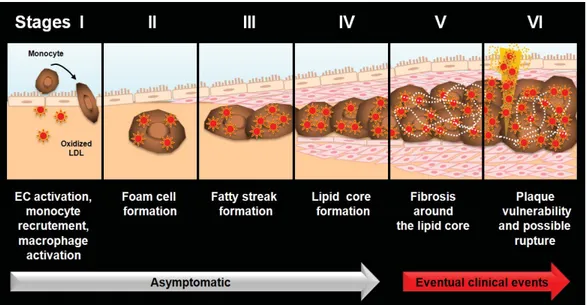 Figure 6: The stages of atherosclerosis development. Stage I: vascular injury leads to 