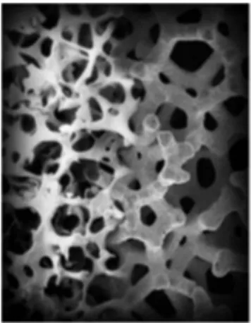 Figure  8 :  Structure  microscopique  métal  trabéculaire  (moitié  droite)  et  os  spongieux  (moitié gauche) (autorisée par Zimmer, Warsaw, IN, USA)