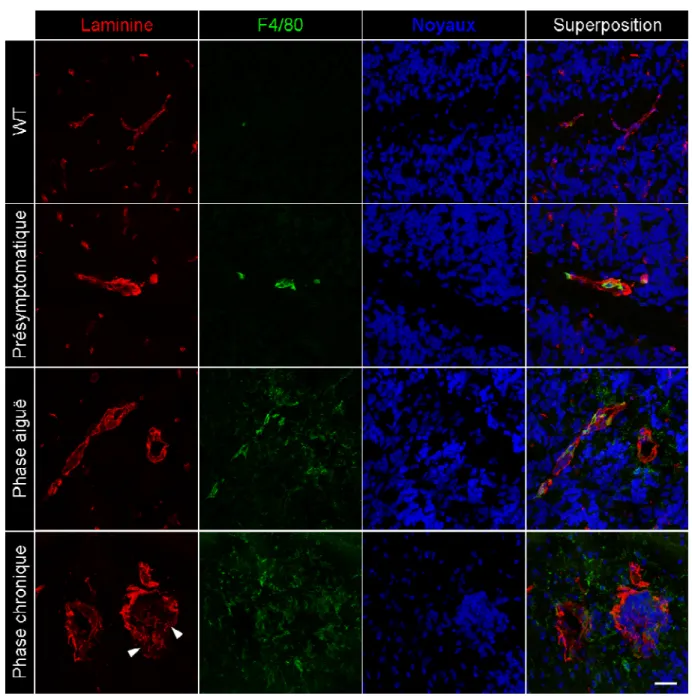 Figure 3. Activation microgliale et infiltration périvasculaire de macrophages lors de  l’EAE spontanée