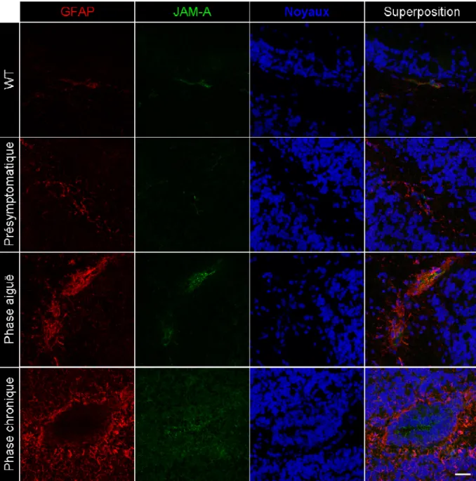 Figure 5. Déstructuration de l’expression de la molécule JAM-A, associée au phénomène  inflammatoire d’astrogliose, lors de l’EAE spontanée