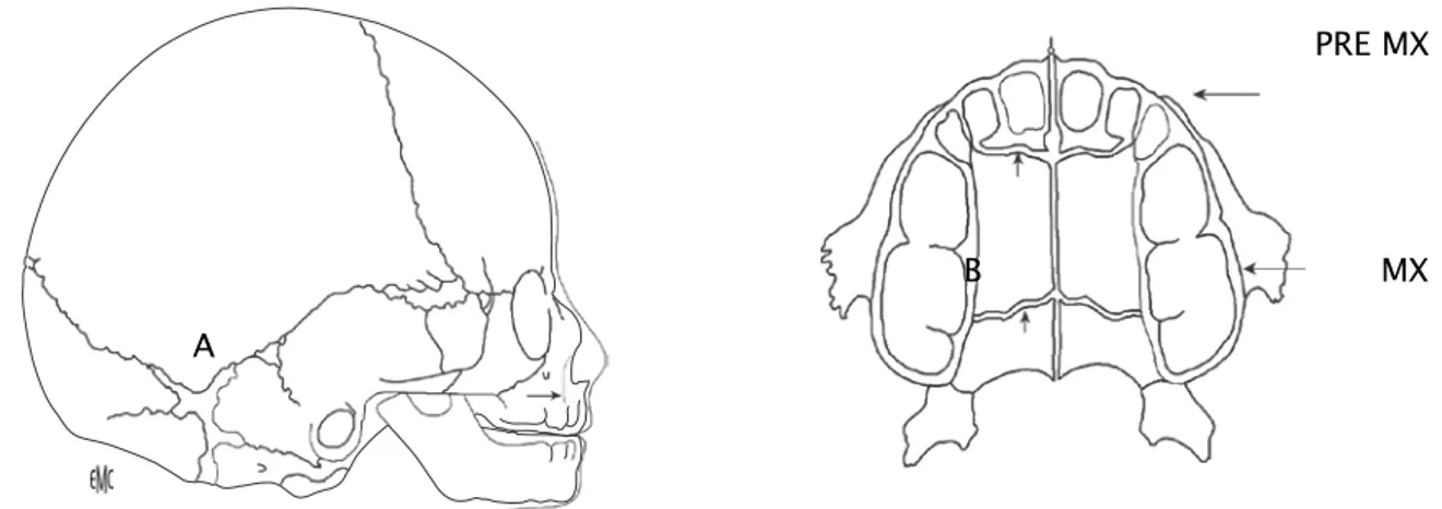 Figure n° 26 : Prémaxillaire  et maxillaire. Le prémaxillaire, issu du bourgeon frontonasal,           se soude  très tôt aux maxillaires issus des bourgeons maxillaires