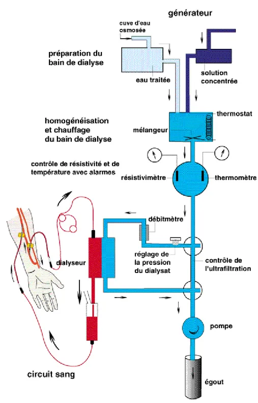 Figure 2 : Générateur d’hémodialyse avec circuit sanguin extra corporel   et le circuit du dialyse 