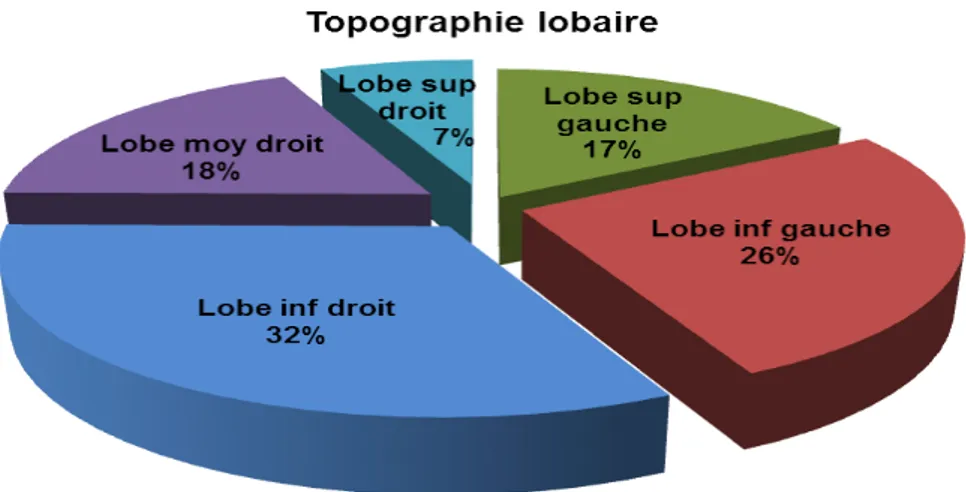 Figure N°7:Topographie lobaire des kystes 