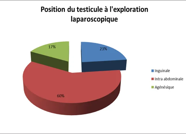 Figure 4: Position du testicule à l’exploration laparoscopique 