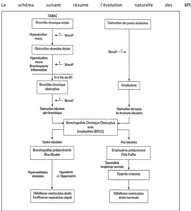 Figure 9: Evolution naturelle des BPCO vers l’insuffisance respiratoire chronique 