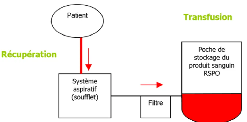 Figure 5 : Récupérateur de sang sans lavage dont le système aspiratif est à soufflet 