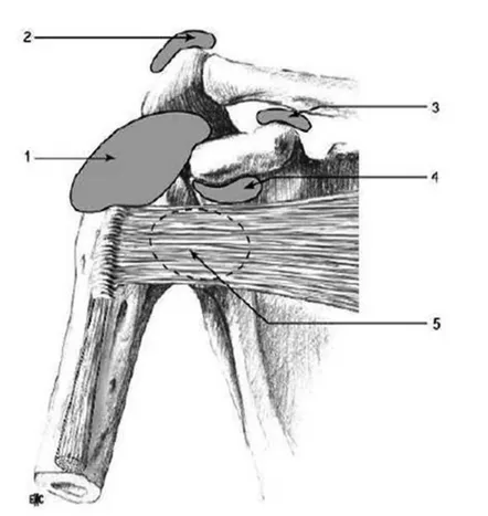 Figure 4: Bourses séreuses de l’épaule.1. Bourse sous-acromio-deltoïdienne; 2. Bourse sus  acromiale; 3