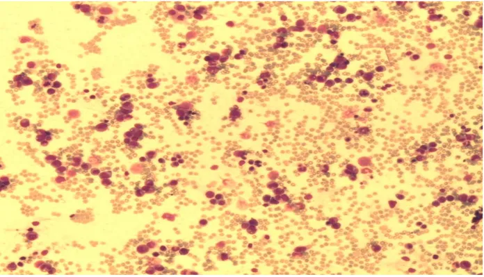 Figure 3 : Moelle de richesse moyenne (Laboratoire d’Hématologie HMA) 