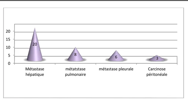 Figure 13 : Types de métastases 