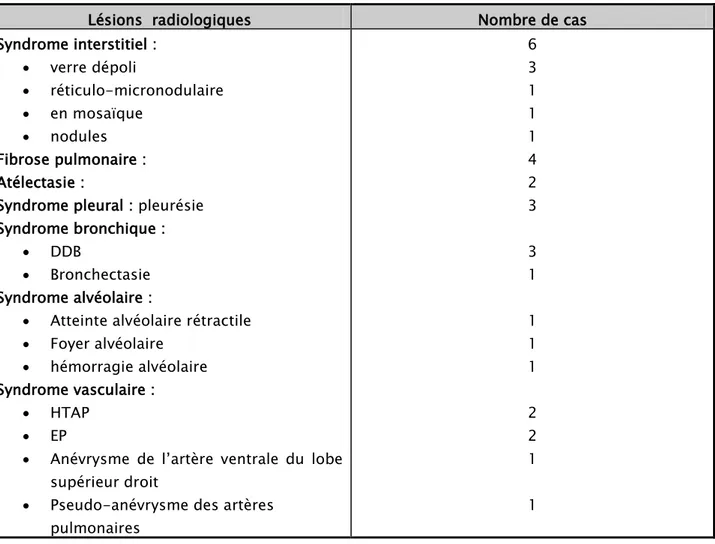 Tableau IV : Résultats  du  scanner  thoracique chez nos patients.  Lésions  radiologiques  Nombre de cas  Syndrome interstitiel :  •  verre dépoli  •  réticulo-micronodulaire  •  en mosaïque  •  nodules  Fibrose pulmonaire :  Atélectasie : 