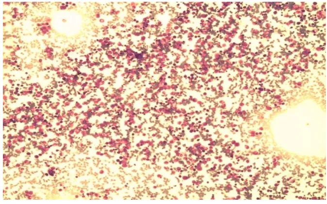 Figure 3 : Moelle riche (Laboratoire d’Hématologie HMA) 
