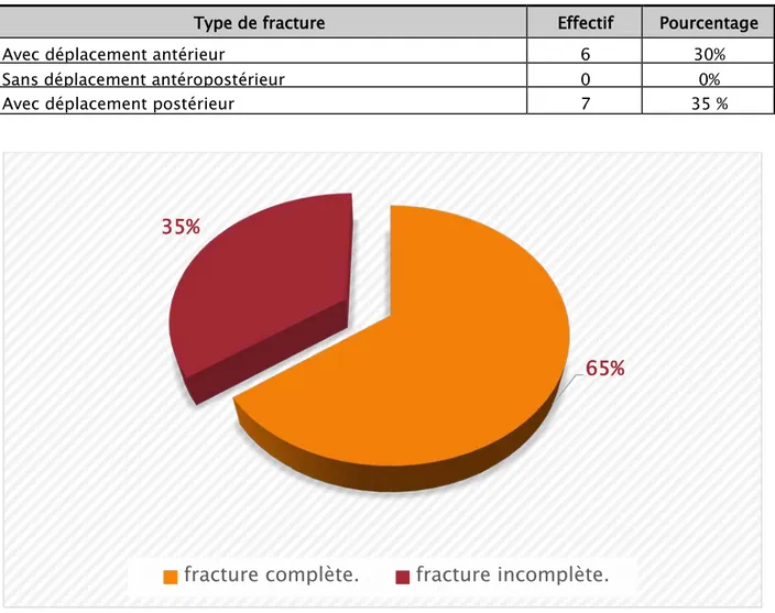 Tableau III : Répartition des fractures complètes 