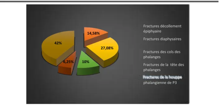 Figure 12  : Répartition selon le site de fracture (n=48). 