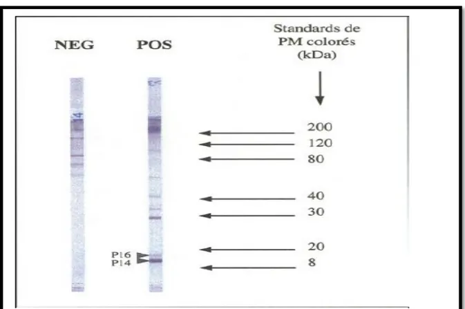 Figure 8  :   Résultats du diagnostic de leishmaniose par le western blot. 