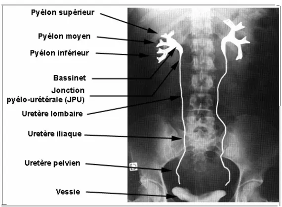 Figure 5: UIV montrant les différentes portions de la voie excrétrice. 