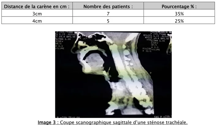 Tableau II : Distance de la carène : 