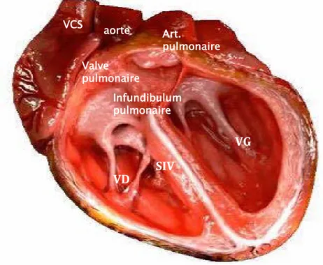 Figure 1 : Anatomie d’un cœur normal (18) 