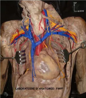 Figure 2: Vue antérieure du thorax après résection claviculaire et ouverture de la cage thoracique (5)