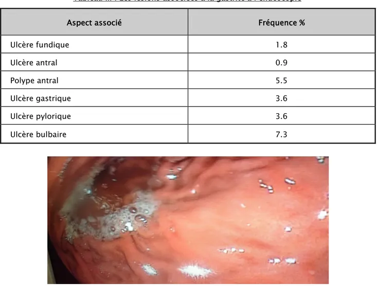 Tableau III : Les lésions associées à la gastrite à l’endoscopie 