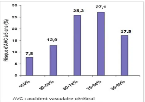 Figure 13: Risque d'AVC à 5 ans en fonction du degré de la sténose carotide au cours de l'étude  NASCET [25]