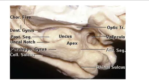 Figure 11: Image de dissection de la face mésiale du lobe temporal gauche centrée   sur l'uncus montrant ses deux segments (47) 