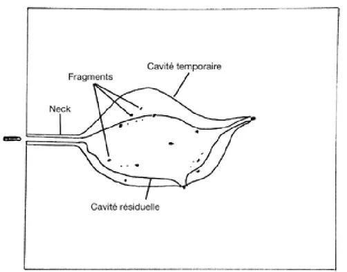 Figure 23. Canal vulnérant en poulpe après fragmentation de la balle. [15] 