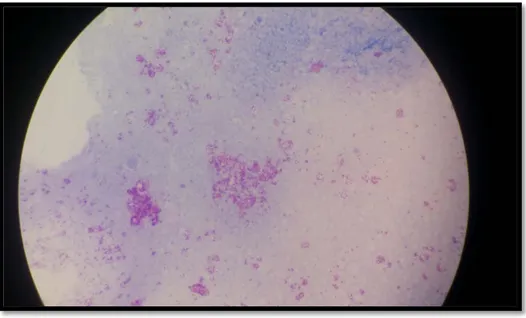 Figure 7 : Aspect de  Mycobacterium tuberculosis  sur examen microscopique direct  d’une culture  positive (photo prise au laboratoire de Microbiologie à l’Hôpital 