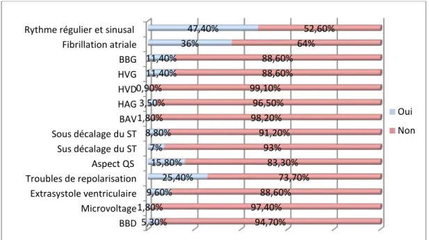 Figure 13 : Répartition des patients selon les anomalies électriques à l’ECG- série de 114  patients insuffisants cardiaques Hôpital Militaire Avicenne- Marrakech 