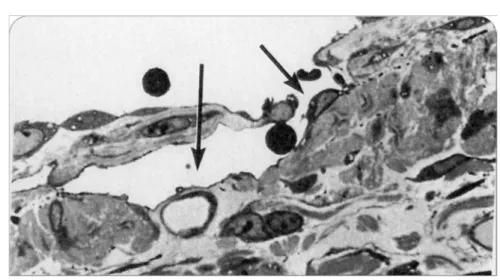 Figure 17 : Pores lymphatiques de WANG de la plèvre pariétale. (13) 