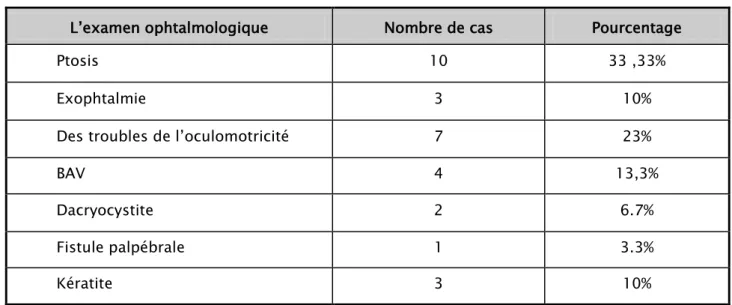 Figure 31: Ethmoïdite aigue compliquée d’une cellulite orbitaire gauche avec abcès palpébral  (photo de professeur rochdi : service ORL CHU mohammed VI marrakech) 