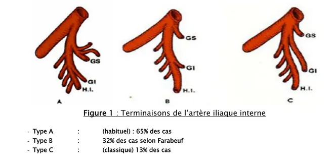 Figure 1 : Terminaisons de l’artère iliaque interne  -  Type A   :   (habituel) : 65% des cas 