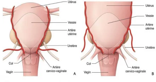 Figure  7 :  modifications des rapports entre les uretères et les artères utérines durant la grossesse 