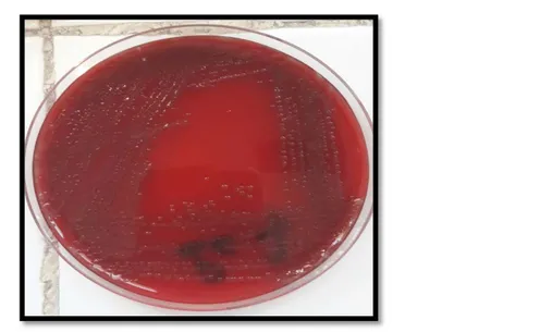 Figure 2 : Des colonies de Streptococcus pneumoniae sur gélose au sang frais ANC (culture de  24heures) 