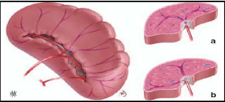 Figure n°5 : Vascularisation intrinsèque de la rate. a : disposition classique, b : disposition la  plus fréquente [5]