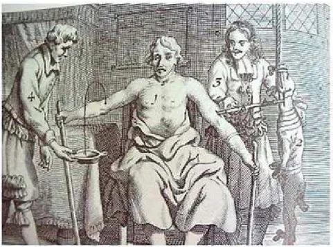 Figure 2 : Jean Scultet : Transfusion de sang d’agneau (1671) 