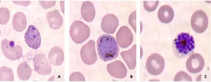 Figure 14 : Plasmodium vivax vu au microscope optique 