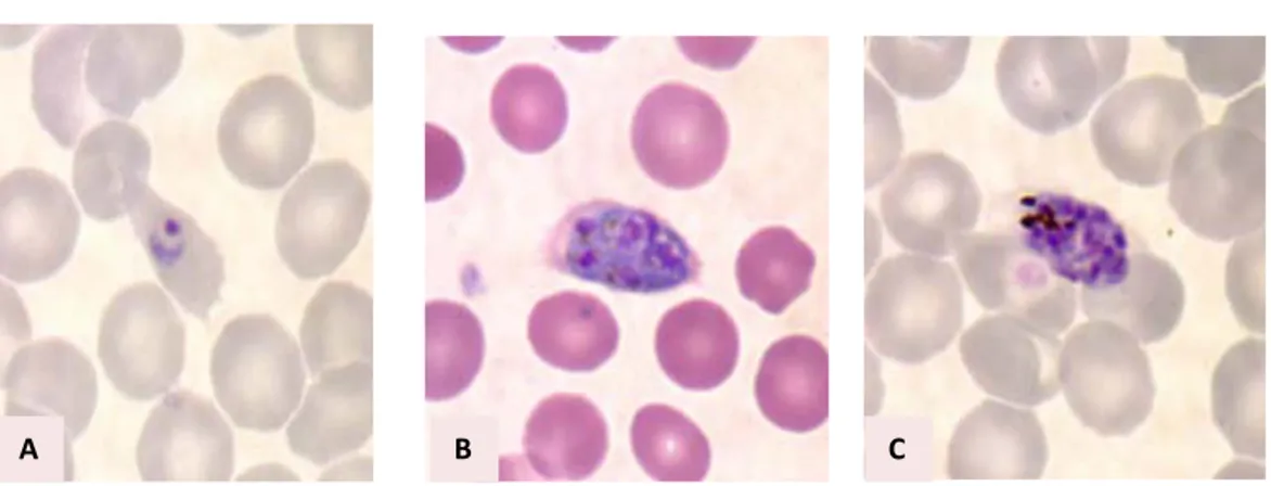 Figure 15: Plasmodium ovale vu au microscope optique  A : Trophozoïte          B : Schizonte         C : Schizonte 