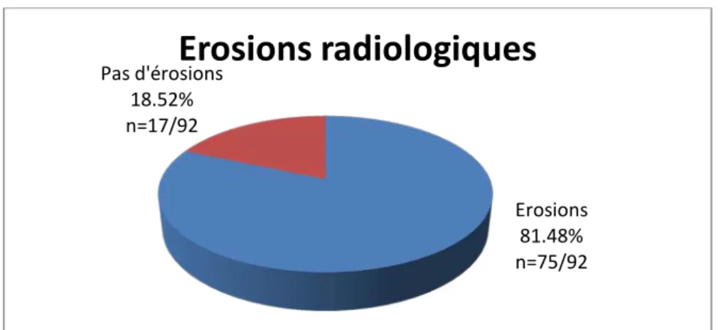Figure 17 : Répartition des malades selon le caractère érosif de la PR. 