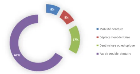 Figure 14 : Répartition des patients selon les signes dentaires associés. 