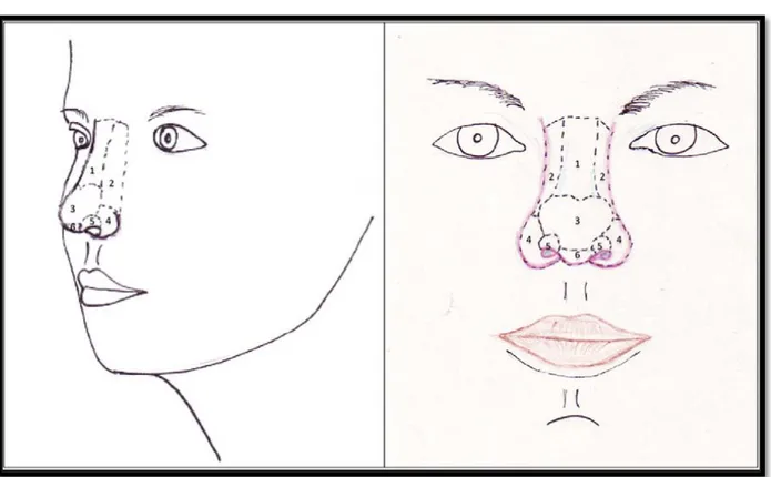 Figure 21: Sous-unités esthétiques du nez selon Burget : Le dorsum (1), les parois latérales (2),  la pointe (3), les ailes narinaires (4), les triangles mou de Converse (5), la columelle (6)