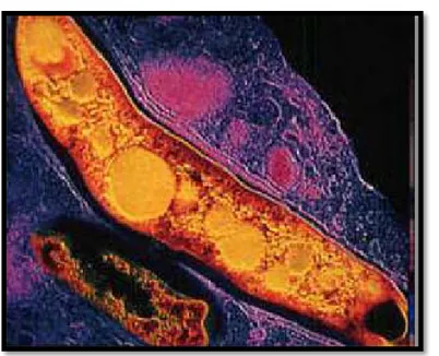 Figure 15: Mycobactérium tuberculosis au microscope électronique. [12] 